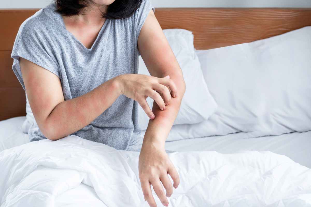 donna con prurito sulle braccia 